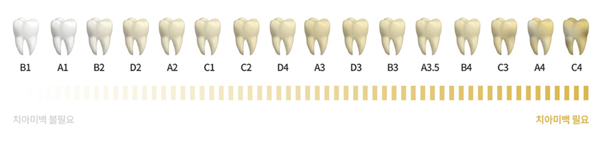 치아 색상 가이드